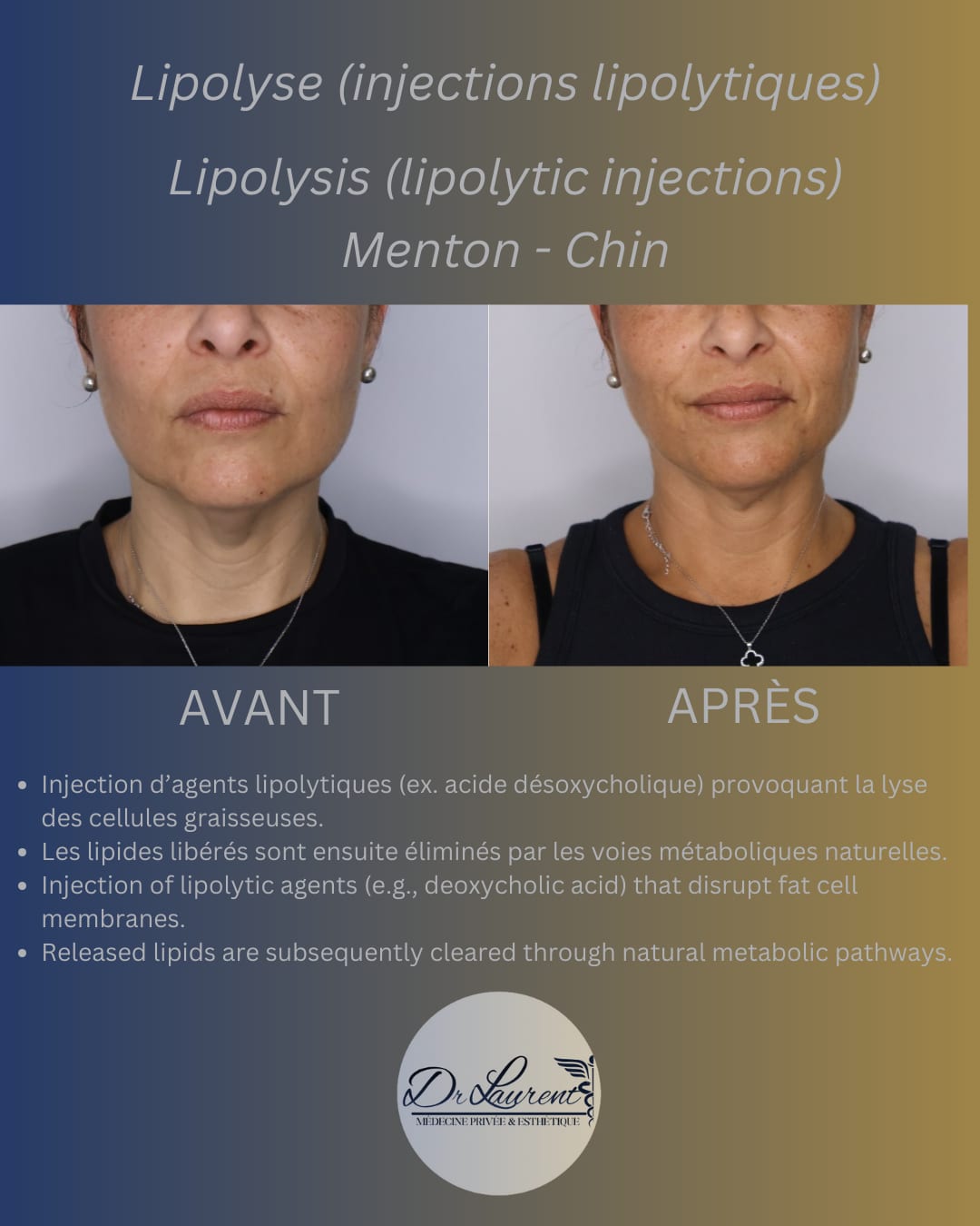 Lipolysis — 2