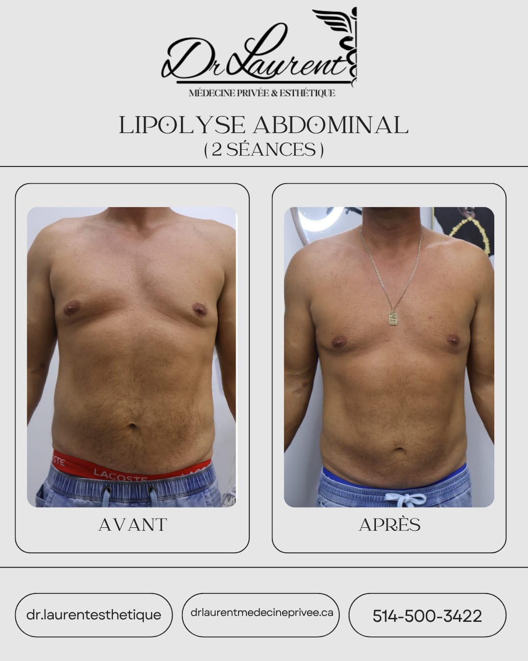 Lipolysis — 4